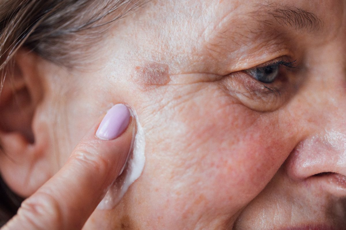 Skin Cancer Awareness Protecting the Skin You’re In. Home Instead of Sunnyvale, CA